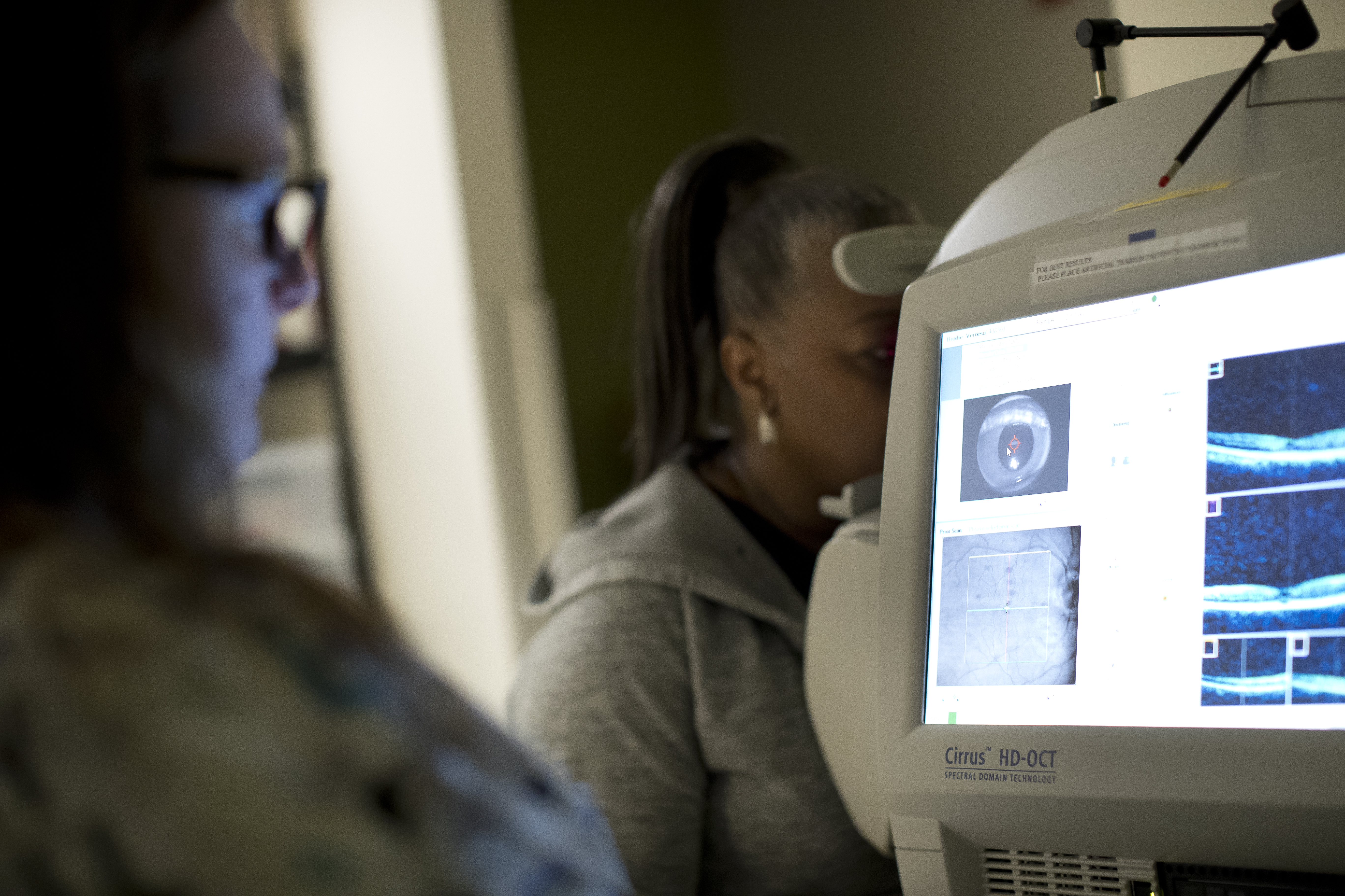 Ocular Eye Emergencies