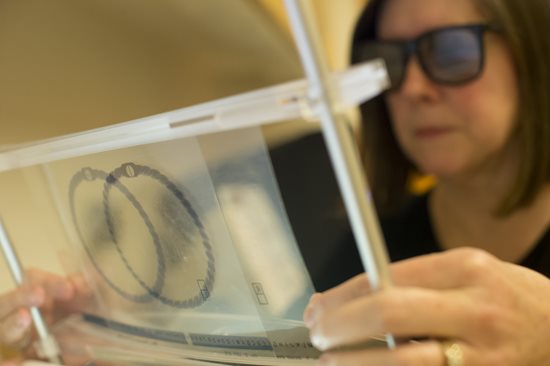Vision Therapy at TEI