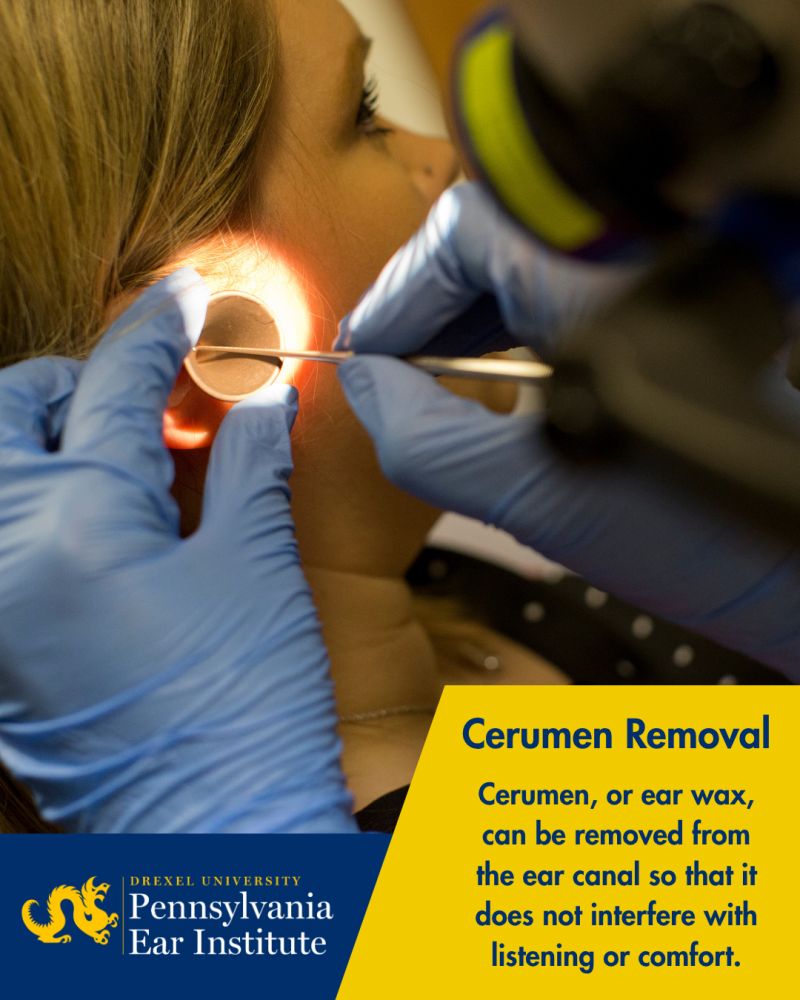cerumen removal