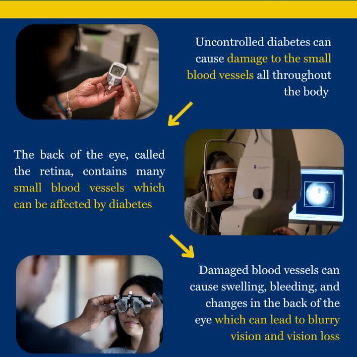 diabetes and the eye flyer