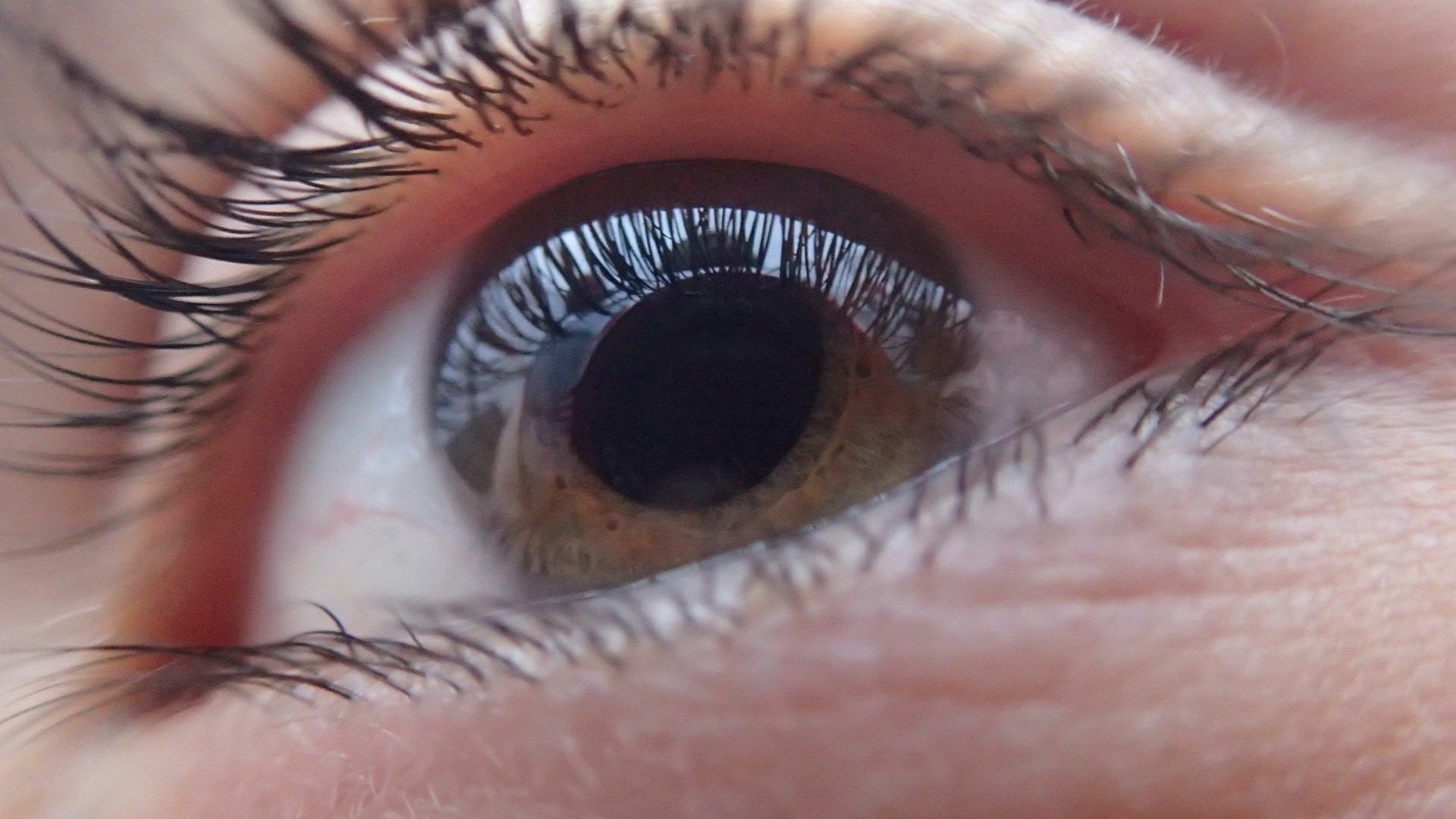Closeup of eyeball