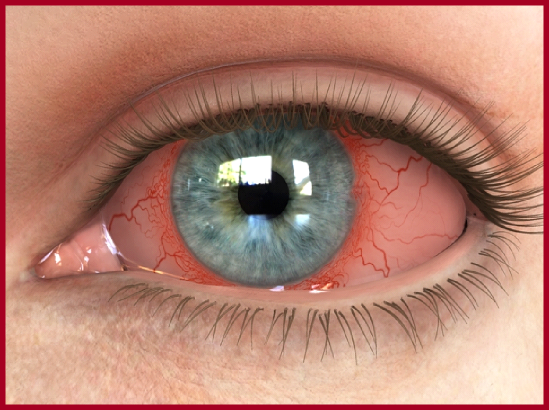 Close up of a big ol' eyeball